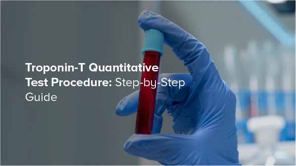 Troponin-T Test Procedure: Complete Step-by-Step Guide